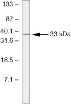 Invitrogen SOCS2 Polyclonal Antibody 100 &mu;g; Unconjugated:Antibodies,