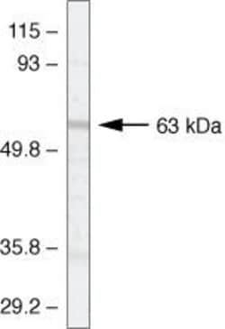 Invitrogen P2Y1 Polyclonal Antibody 100 &mu;g; Unconjugated:Antibodies,