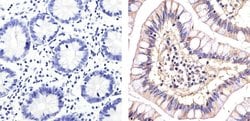 Invitrogen CD146 Polyclonal Antibody 100 &mu;g; Unconjugated:Antibodies,