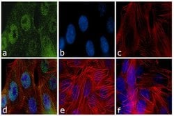 Invitrogen Cdc14A Polyclonal Antibody 100 &mu;g; Unconjugated:Antibodies,