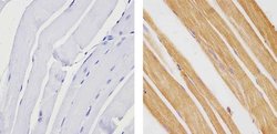 Invitrogen TBX1 Polyclonal Antibody 100 &mu;g | Buy Online | Invitrogen&trade; | Fisher Scientific