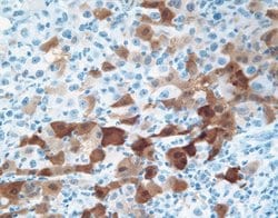 Invitrogen NY-ESO-1 Monoclonal Antibody (E978) 100 &mu;g; Unconjugated:Antibodies,