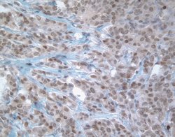 Invitrogen MGMT Monoclonal Antibody (MT23.2) 100 &mu;g; Unconjugated:Antibodies,