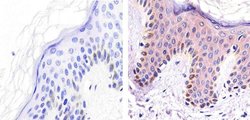 Invitrogen ALK Monoclonal Antibody (4C5B8) 100 &mu;g; Unconjugated:Antibodies,