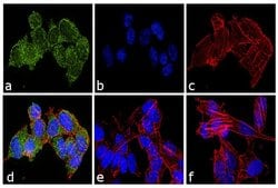 Invitrogen Ubiquilin 2 Monoclonal Antibody (3B8A10) 100 &mu;g; Unconjugated:Anticuerpos
