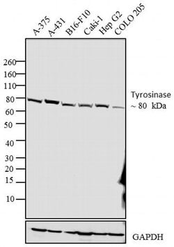 Invitrogen Tyrosinase Monoclonal Antibody (T311) 100 &mu;g; Unconjugated:Antibodies,