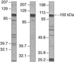 Invitrogen VAV2 Polyclonal Antibody 100 &mu;g | Buy Online | Invitrogen&trade; | Fisher Scientific
