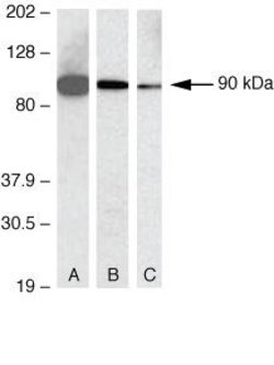 Invitrogen CD138 Polyclonal Antibody 100 &mu;g; Unconjugated:Antibodies,