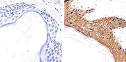 Invitrogen CD138 Polyclonal Antibody 100 &mu;g; Unconjugated:Antibodies,