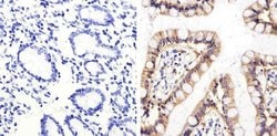 Invitrogen CD138 Polyclonal Antibody 100 &mu;g; Unconjugated:Antibodies,