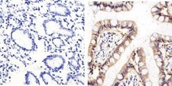 Invitrogen CD138 Polyclonal Antibody 100 &mu;g; Unconjugated:Antibodies,