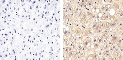Invitrogen Claudin 14 Polyclonal Antibody 100 &mu;g; Unconjugated:Antibodies,