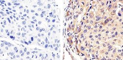 Invitrogen Syndecan 2 Polyclonal Antibody 100 &mu;g; Unconjugated:Antibodies,