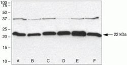 Invitrogen Syndecan 2 Polyclonal Antibody 100 &mu;g; Unconjugated:Antibodies,