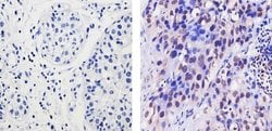 Invitrogen EZH2 Polyclonal Antibody 100 &mu;g; Unconjugated:Antibodies,