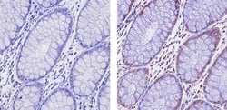Invitrogen EZH2 Polyclonal Antibody 100 &mu;g; Unconjugated:Antibodies,