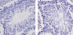 Invitrogen EZH2 Polyclonal Antibody 100 &mu;g; Unconjugated:Antibodies,