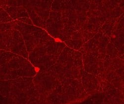 Invitrogen Phospho-Tyrosine Hydroxylase (Ser31) Polyclonal Antibody 100