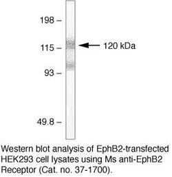 Invitrogen EphB2 Monoclonal Antibody (1A6C9) 100 &mu;g; Unconjugated:Antibodies,