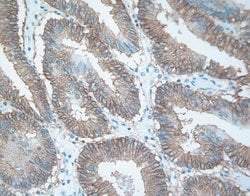 Invitrogen EphB4 Monoclonal Antibody (3D7G8) 100 &mu;g; Unconjugated:Antibodies,