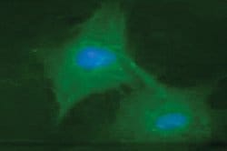 Invitrogen CD171 Monoclonal Antibody (L1.1) 100 &mu;g; Unconjugated:Antibodies,