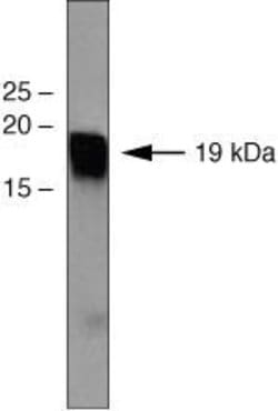 Invitrogen p19 INK4d Monoclonal Antibody (2D2G4) 100 &mu;g; Unconjugated:Antibodies,