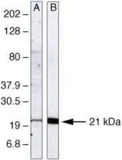 Invitrogen UBC13 Monoclonal Antibody (4E 11) 100 &mu;g; Unconjugated:Antibodies,