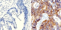 Invitrogen Claudin 7 Monoclonal Antibody (5D10F3) 100 &mu;g; Unconjugated:Antibodies,