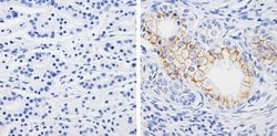 Invitrogen Claudin 7 Monoclonal Antibody (5D10F3) 100 &mu;g; Unconjugated:Antibodies,