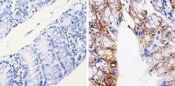 Invitrogen Claudin 7 Monoclonal Antibody (5D10F3) 100 &mu;g; Unconjugated:Antibodies,