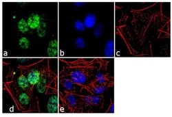 Invitrogen Ubiquilin 2 Monoclonal Antibody (3D5E2) 100 &mu;g; Unconjugated:Anticuerpos
