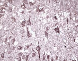 Invitrogen PGP9.5 Polyclonal Antibody 100 &mu;g; Unconjugated:Antibodies,