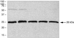 Invitrogen PGP9.5 Polyclonal Antibody 100 &mu;g; Unconjugated:Antibodies,