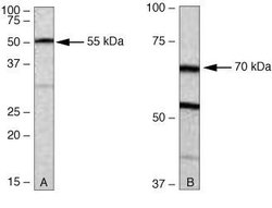 Invitrogen PKC zeta Polyclonal Antibody 100 &mu;g; Unconjugated:Antibodies,