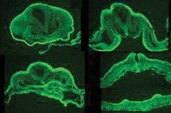 Invitrogen WNT6 Polyclonal Antibody 100 &mu;g | Buy Online | Invitrogen&trade; | Fisher Scientific