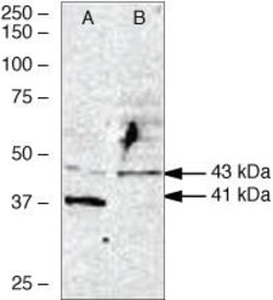 Invitrogen WNT2B Polyclonal Antibody 100 &mu;g | Buy Online | Invitrogen&trade; | Fisher Scientific