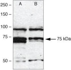 IRAK1 Rabbit anti-Human, Polyclonal, Invitrogen 100 &mu;g | Buy Online | Invitrogen | Fisher Scientific