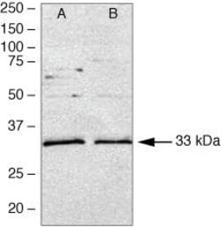 MyD88 Polyclonal Antibody, Invitrogen 100 &mu;g; Unconjugated:Antibodies,