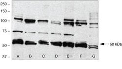 Invitrogen BMPR1A Polyclonal Antibody 100 &mu;g; Unconjugated:Antibodies,