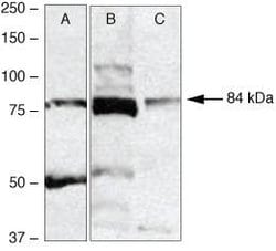 Invitrogen RSK2 Polyclonal Antibody 100 &mu;g | Buy Online | Invitrogen&trade; | Fisher Scientific