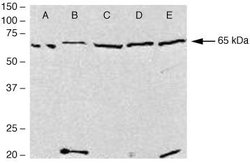 PDLIM5 Polyclonal Antibody, Invitrogen 100 &mu;g | Buy Online | Invitrogen | Fisher Scientific