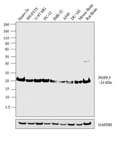 Invitrogen PGP9.5 Polyclonal Antibody 100 &mu;g; Unconjugated:Antibodies,