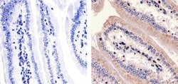 Invitrogen PKC zeta Polyclonal Antibody 100 &mu;g; Unconjugated:Antibodies,