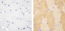 Invitrogen VPS34 Polyclonal Antibody 100 &mu;g; Unconjugated:Antibodies,