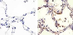 Invitrogen Claudin 18 Polyclonal Antibody 100 &mu;g; Unconjugated:Antibodies,