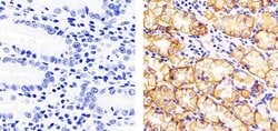 Invitrogen Claudin 18 Polyclonal Antibody 100 &mu;g; Unconjugated:Antibodies,