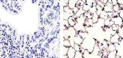 Invitrogen Claudin 18 Polyclonal Antibody 100 &mu;g; Unconjugated:Antibodies,