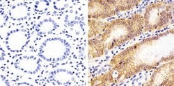 Invitrogen Claudin 18 Polyclonal Antibody 100 &mu;g; Unconjugated:Antibodies,