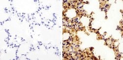 Invitrogen Claudin 18 Polyclonal Antibody 100 &mu;g; Unconjugated:Antibodies,