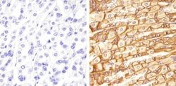 Invitrogen Claudin 18 Polyclonal Antibody 100 &mu;g; Unconjugated:Antibodies,
